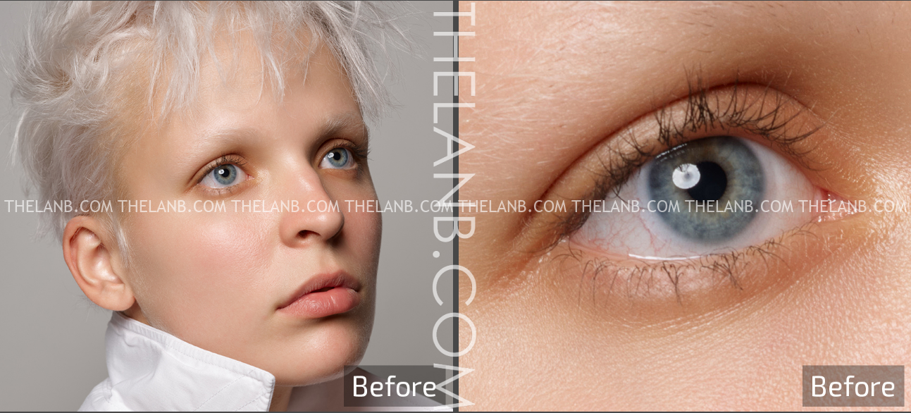 instal the new for windows Retouch4me Heal 1.018 / Dodge / Skin Tone
