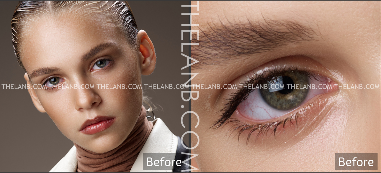 Retouch4me Heal 1.018 / Dodge / Skin Tone instal the new for android